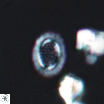 Cribrosphaerella ehrenbergii 8618