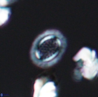 Cribrosphaerella ehrenbergii 8620