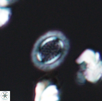Cribrosphaerella ehrenbergii 8620