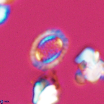 Cribrosphaerella ehrenbergii 8621