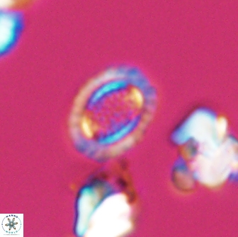 Cribrosphaerella ehrenbergii 8621