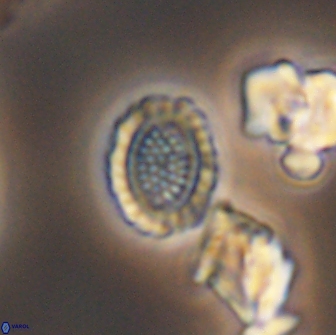 Cribrosphaerella ehrenbergii 8622