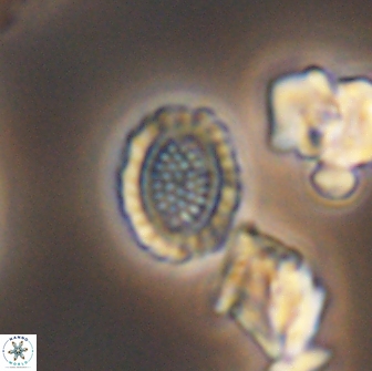 Cribrosphaerella ehrenbergii 8622