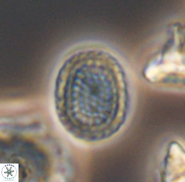 Cribrosphaerella ehrenbergii 9910