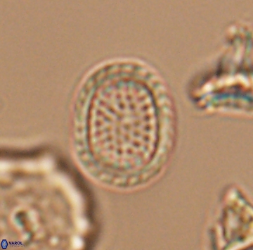 Cribrosphaerella ehrenbergii 9911