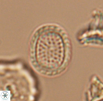 Cribrosphaerella ehrenbergii 9911