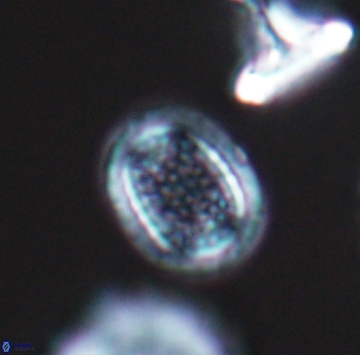 Cribrosphaerella ehrenbergii 9912