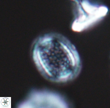 Cribrosphaerella ehrenbergii 9912