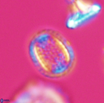 Cribrosphaerella ehrenbergii 9913