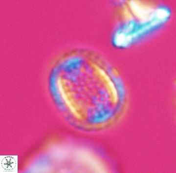 Cribrosphaerella ehrenbergii 9913