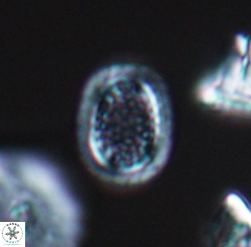 Cribrosphaerella ehrenbergii 9914