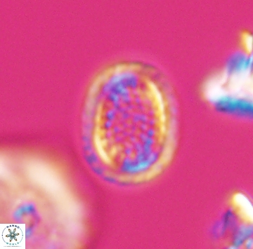 Cribrosphaerella ehrenbergii 9915