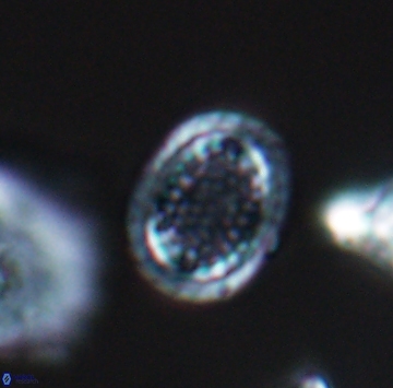 Cribrosphaerella ehrenbergii 9916