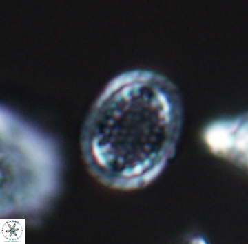 Cribrosphaerella ehrenbergii 9916