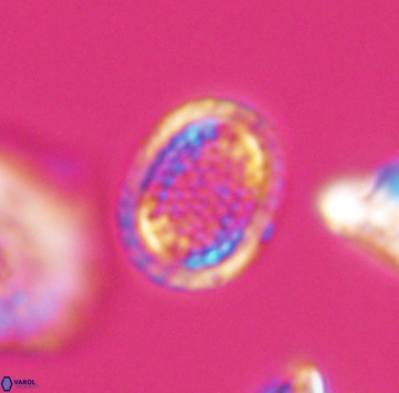 Cribrosphaerella ehrenbergii 9917