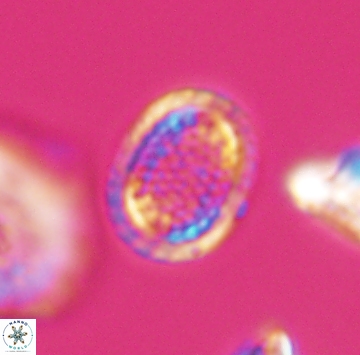 Cribrosphaerella ehrenbergii 9917