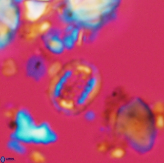 Cribrosphaerella linea 1507
