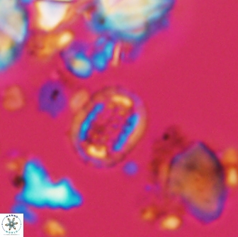 Cribrosphaerella linea 1507