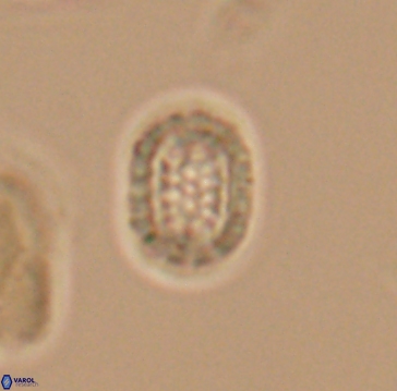 Cribrosphaerella linea 10004