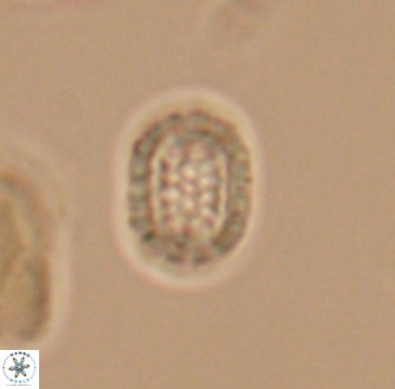 Cribrosphaerella linea 10004