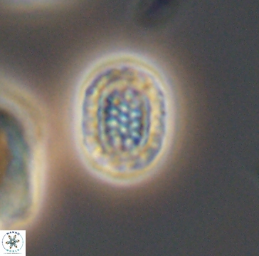 Cribrosphaerella linea 10005