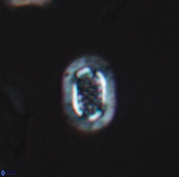 Cribrosphaerella linea 10000