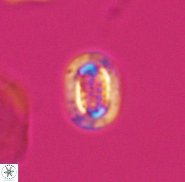 Cribrosphaerella linea 10001