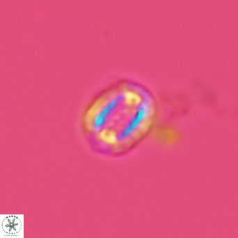 Cribrosphaerella linea 3004
