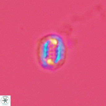 Cribrosphaerella linea 3005