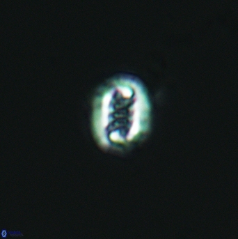 Cribrosphaerella linea 3006