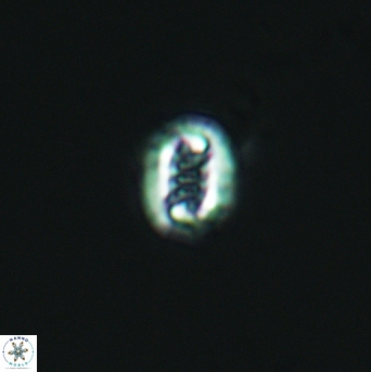 Cribrosphaerella linea 3006