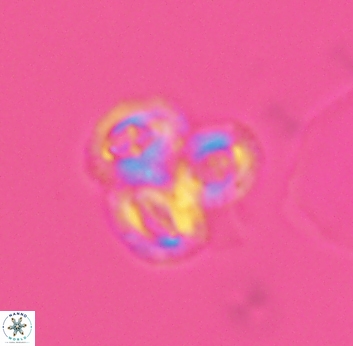 Crucibiscutum bosunensis 2732