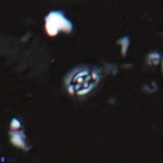 Crucibiscutum hayii 17026