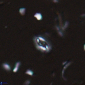Crucibiscutum salebrosum 17033