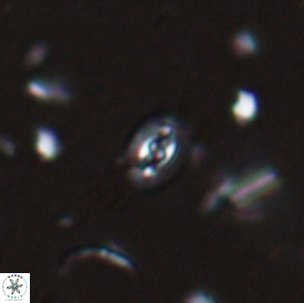Crucibiscutum salebrosum 17035