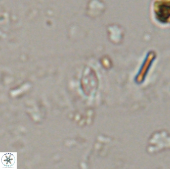 Crucibiscutum salebrosum 17037