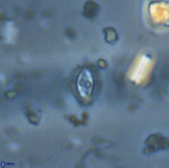 Crucibiscutum salebrosum 17038