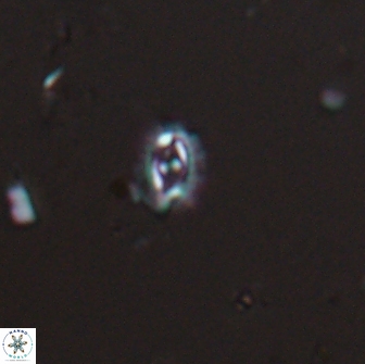 Crucibiscutum salebrosum 17052