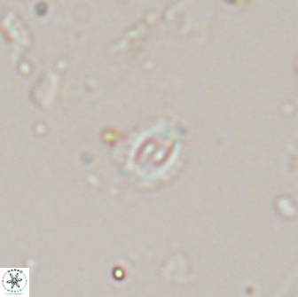 Crucibiscutum salebrosum 17058
