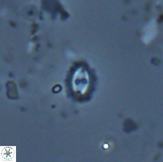 Crucibiscutum salebrosum 17059