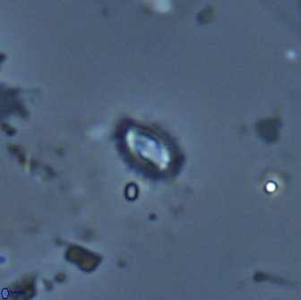 Crucibiscutum salebrosum 17061