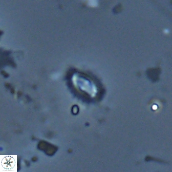 Crucibiscutum salebrosum 17061