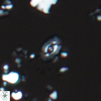 Crucibiscutum salebrosum 18655