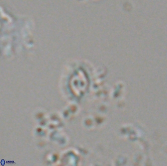 Crucibiscutum salebrosum 18657