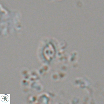 Crucibiscutum salebrosum 18657