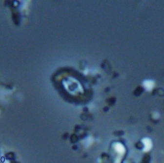 Crucibiscutum salebrosum 18660
