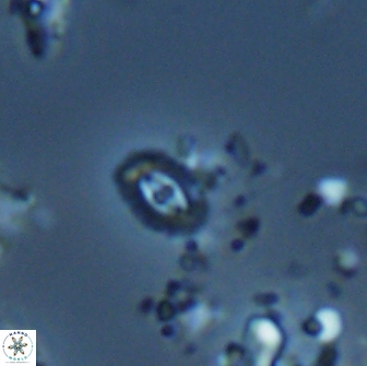 Crucibiscutum salebrosum 18660