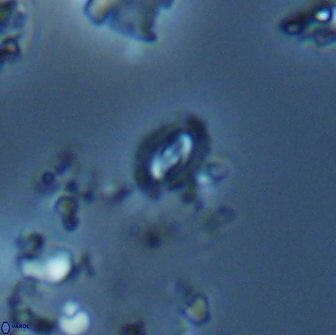 Crucibiscutum salebrosum 18661