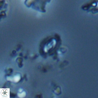 Crucibiscutum salebrosum 18661