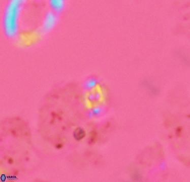 Crucibiscutum salebrosum 2935